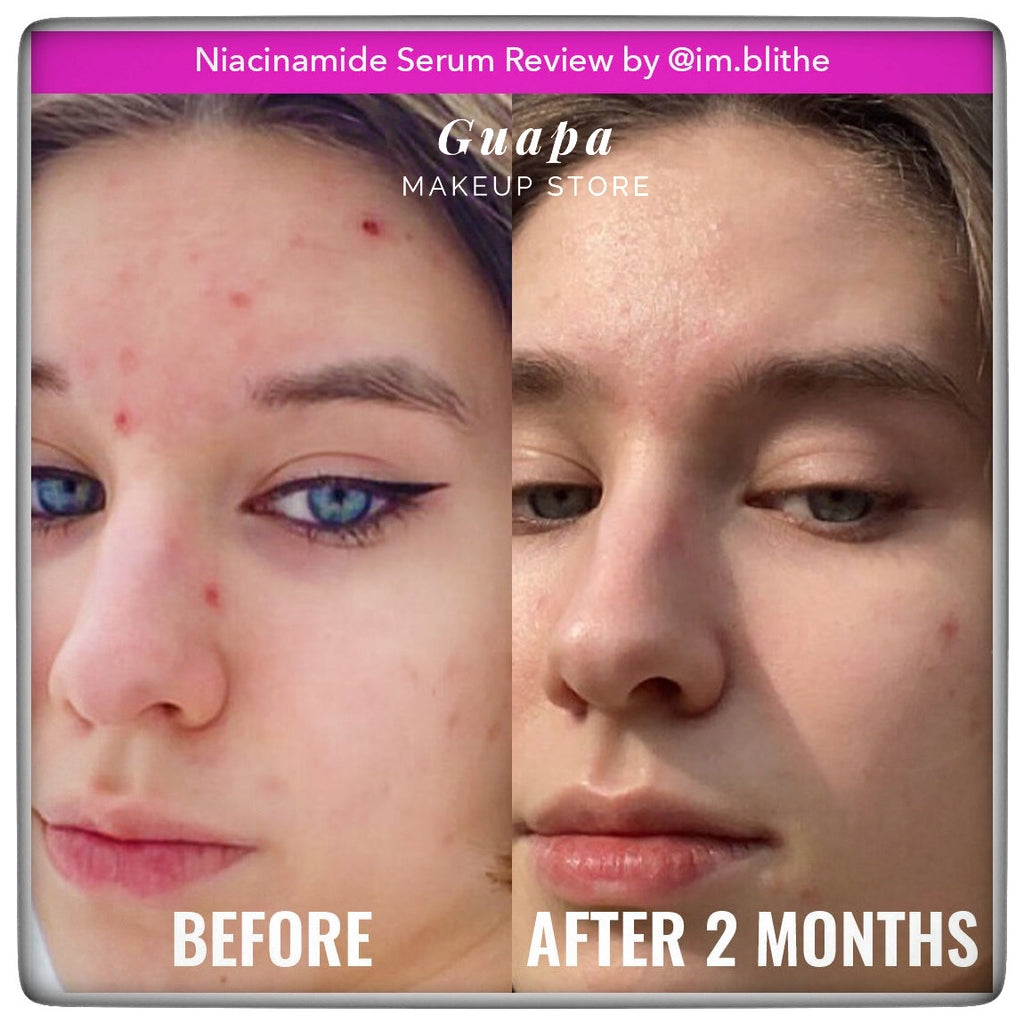 Niacinamide Good Molecules