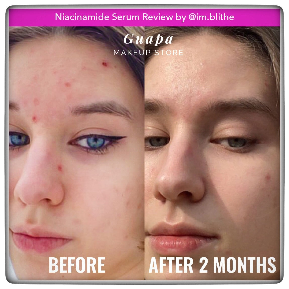 Niacinamide Good Molecules