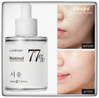 Serúm de retinol koreano